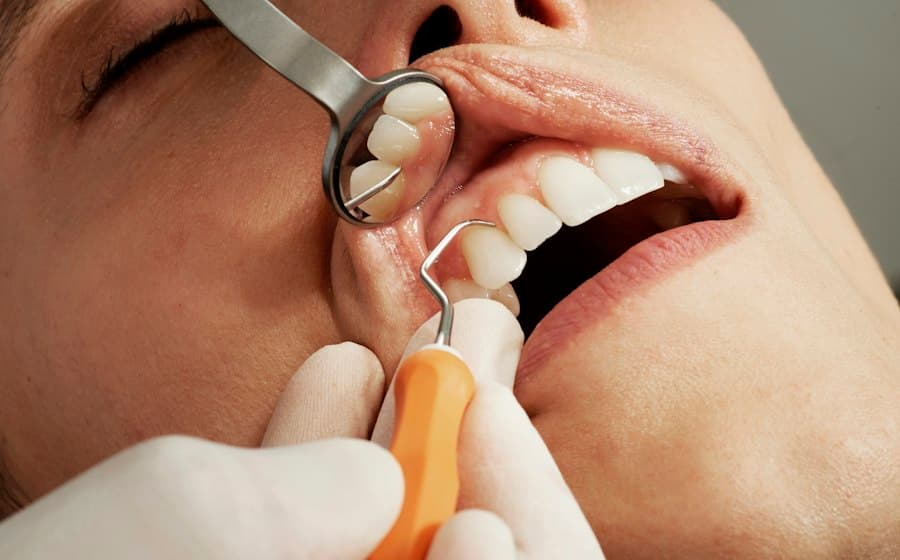 Paciente sorrindo durante avaliação odontológica com espelho clínico