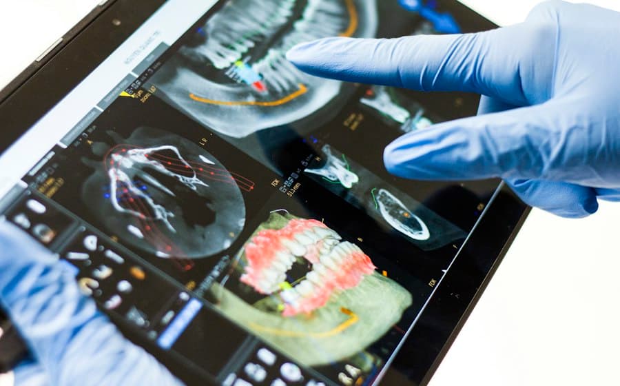 Planejamento digital do sorriso exibido em um tablet